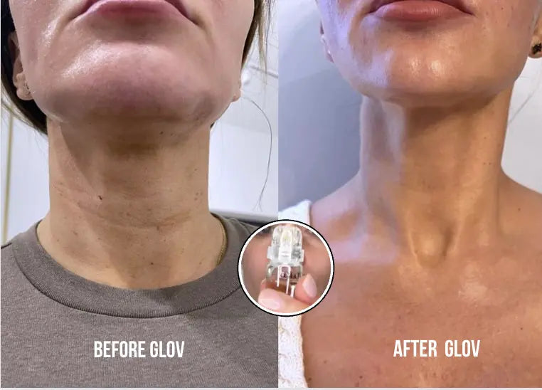 Anti-Aging treatment - Glov Beauty