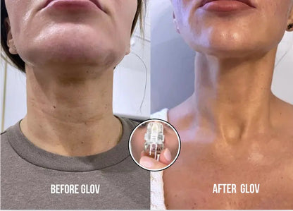 Anti-Aging treatment - Glov Beauty