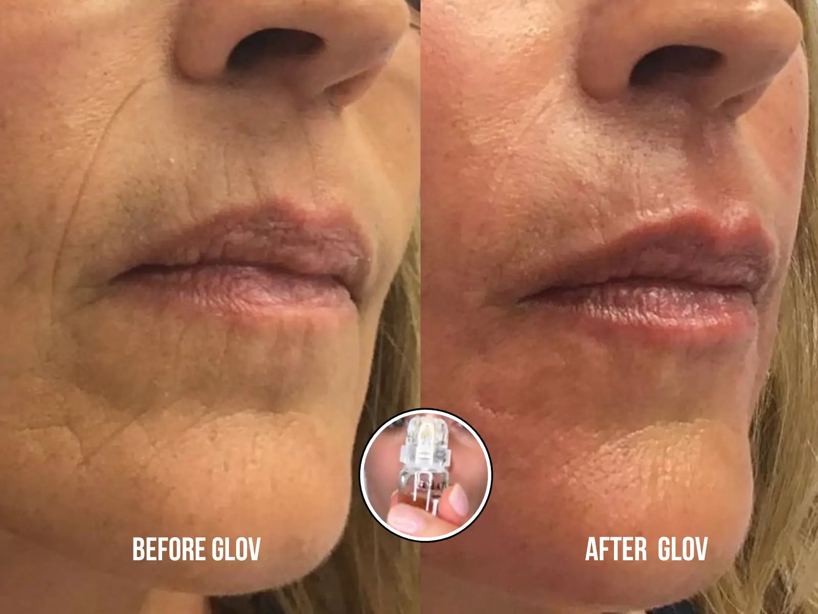 Glov Anti-Aging Serum (5ml) - Glov Beauty