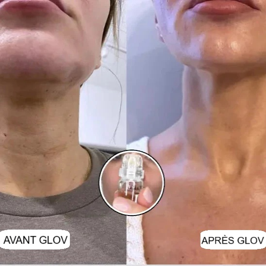 Glov Micro Infusion System - Glov Beauty