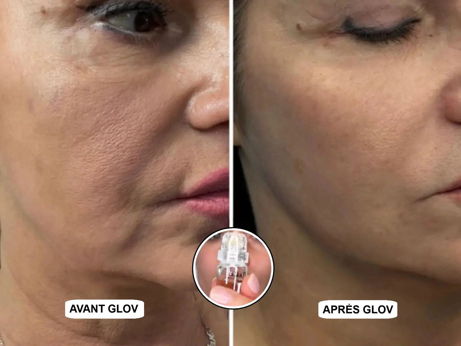 Glov Micro Infusion System - Glov Beauty