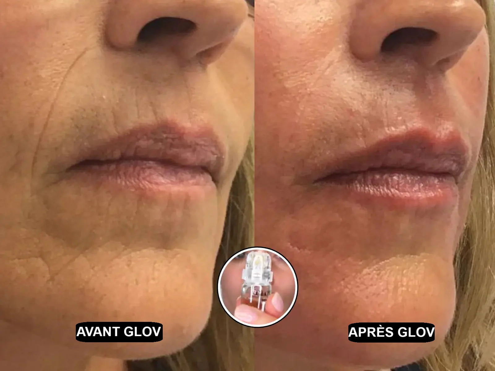 Glov Micro Infusion System - Glov Beauty