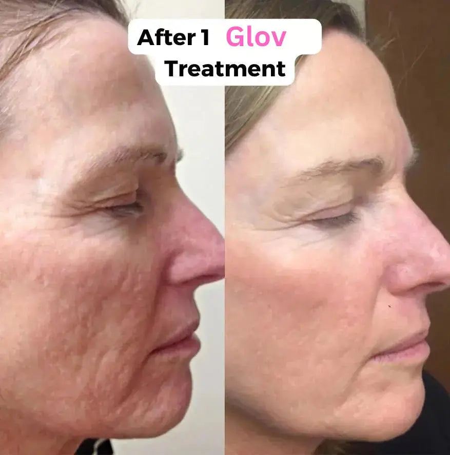Glov Micro Infusion System (dummy) Glov Beauty