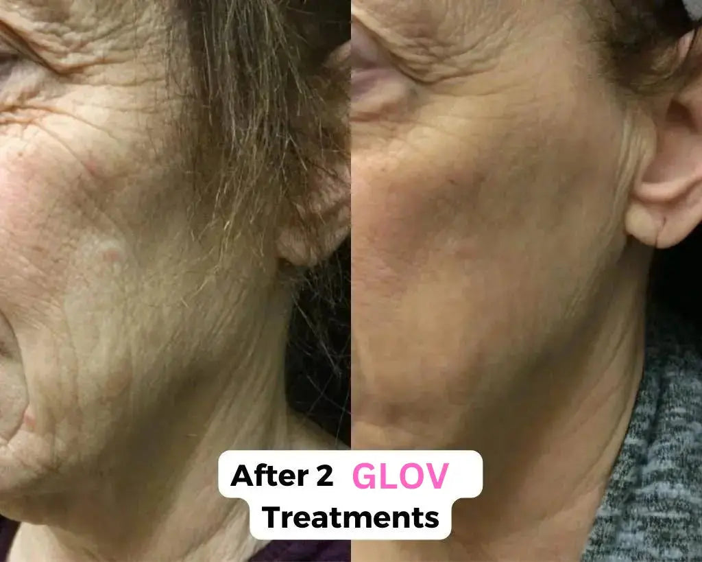 Glov Micro Infusion System (dummy) Glov Beauty