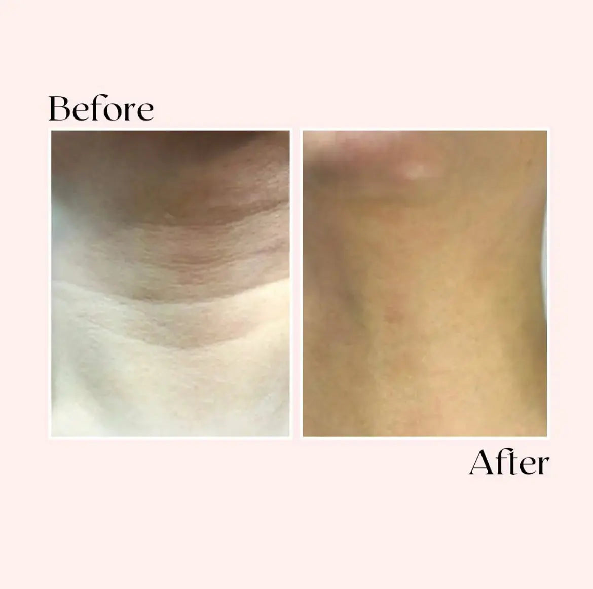Glov Micro Infusion System (dummy) Glov Beauty