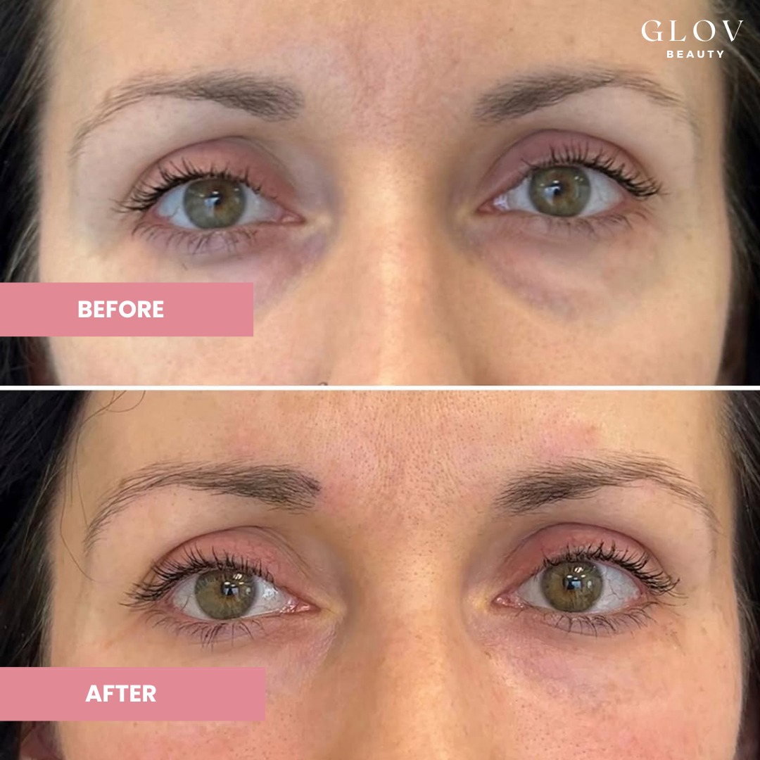 Crème Contour des Yeux Glov – Hydratation & Éclat