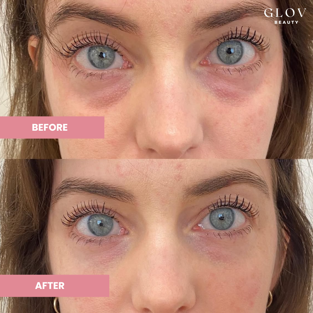 Crème Contour des Yeux Glov – Hydratation & Éclat