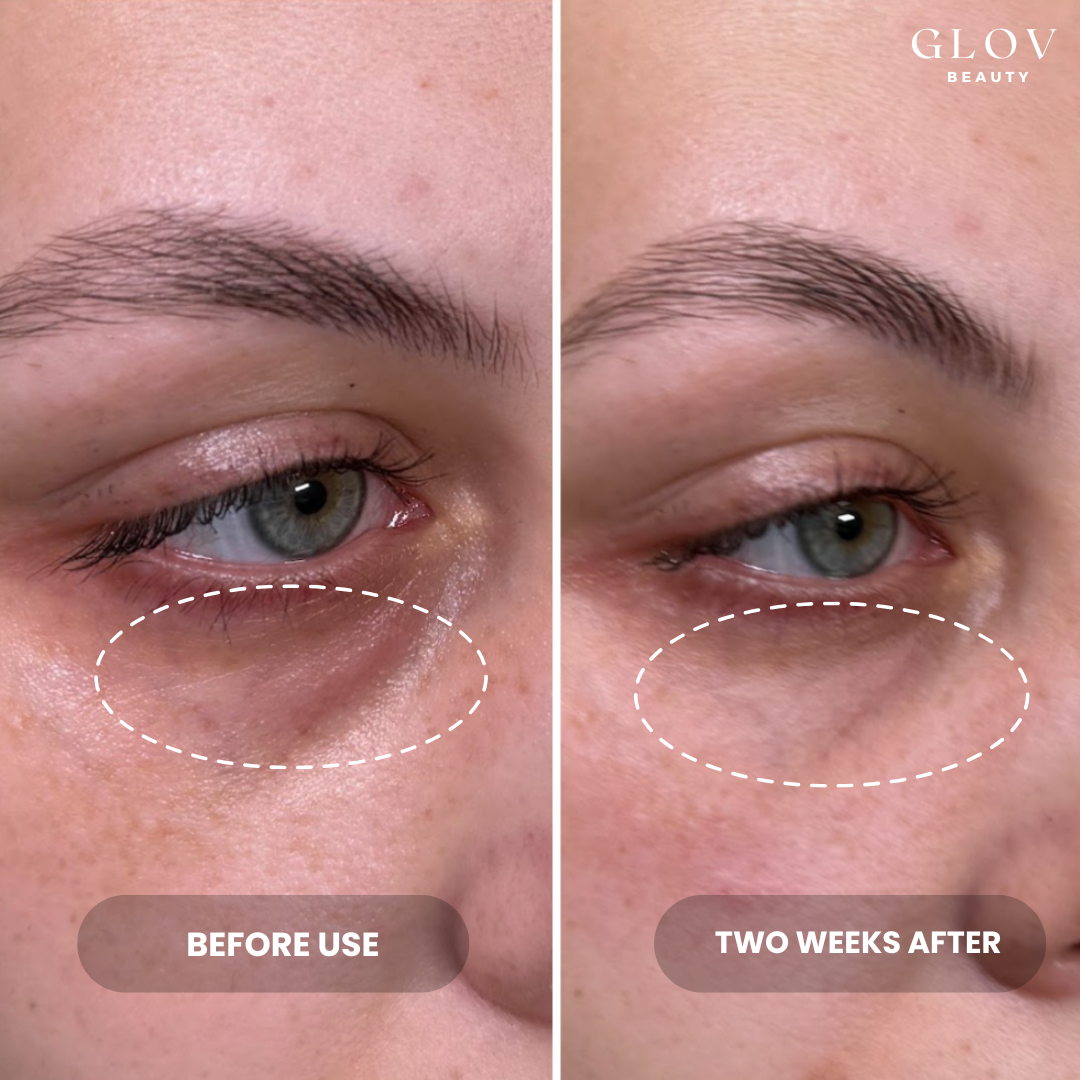 Crème Contour des Yeux Glov – Hydratation & Éclat