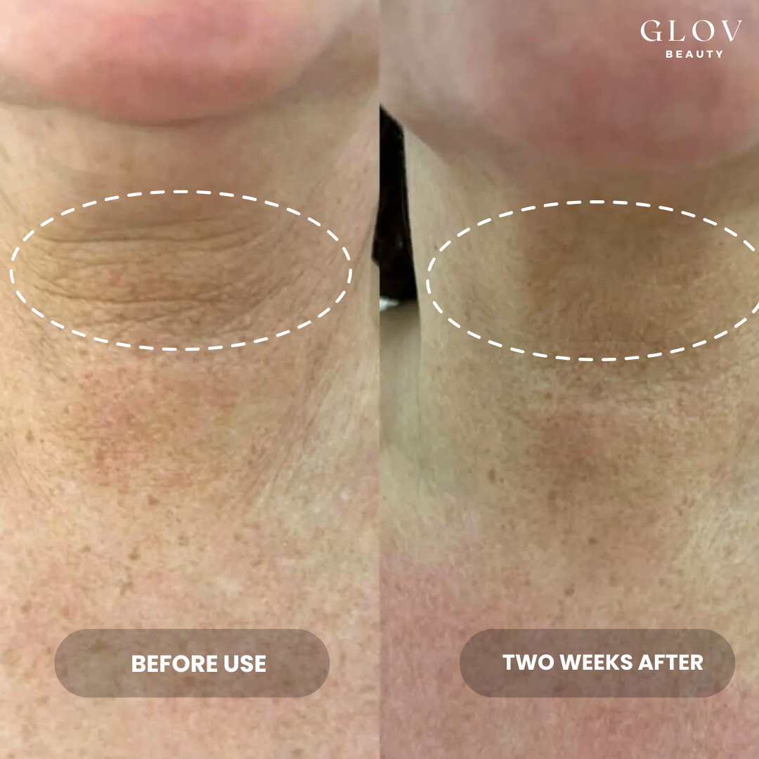 Crème Cou et Décolleté Glov – Lift & Fermeté